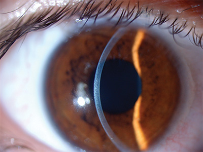 Anatomy of the Eye - Retina-Vitreous Surgeons of CNY