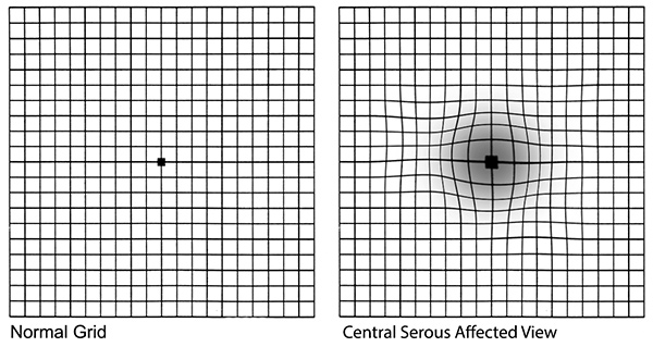 CSC Grid