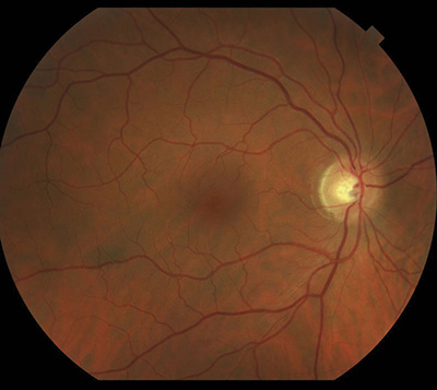 Anatomy of the Eye - Retina-Vitreous Surgeons of CNY