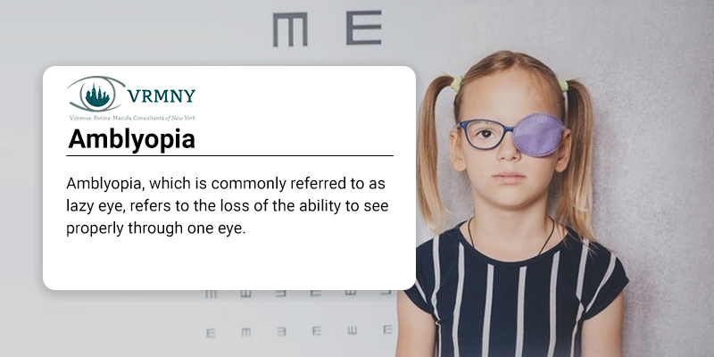 Amblyopia
