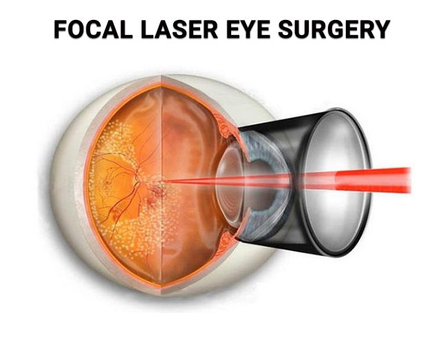 How to Get Rid of Puffy Eyes Will Vision and Lasik Centers