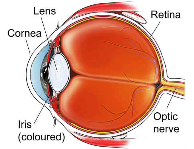 Cirugía del glaucoma